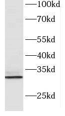 CXorf56/MRX107 Antibody - BSA Free