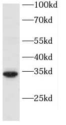 PBDC1 Antibody - BSA Free