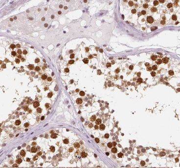 CCDC49 Antibody - BSA Free