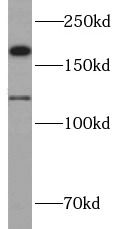 CTTNBP2 Antibody - BSA Free