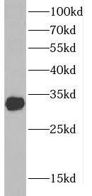 CTDSP1 Antibody - BSA Free