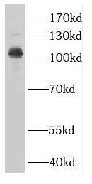 CTAGE5 Antibody - BSA Free