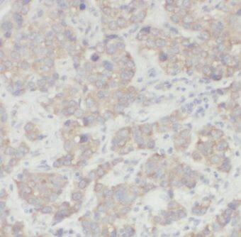 CSN3 Antibody - BSA Free