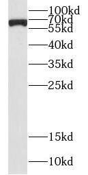 CSGALNACT2 Antibody - BSA Free