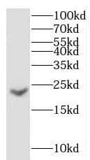 gamma C Crystallin Antibody - BSA Free