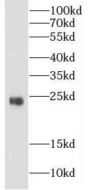 CRYBB3 Antibody - BSA Free