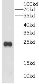 CRYBB2 Antibody - BSA Free
