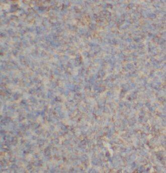 CSTP1 Antibody - BSA Free