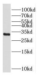 CSTP1 Antibody - BSA Free