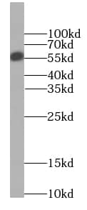CPNE9 Antibody - BSA Free