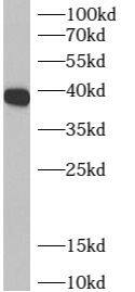 ADPRHL2 Antibody - BSA Free