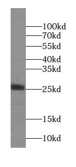 NAA11 Antibody - BSA Free