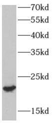 AP3S2 Antibody - BSA Free