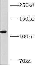 AP3D1 Antibody - BSA Free