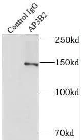 AP3B2 Antibody - BSA Free