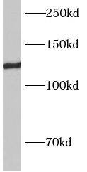 AP3B2 Antibody - BSA Free