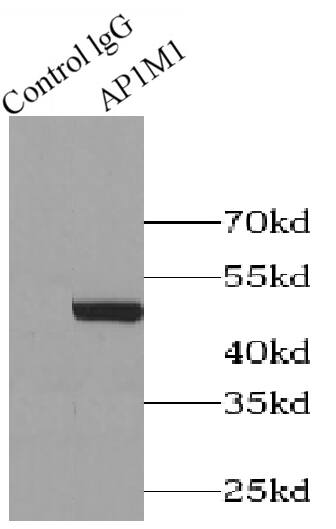 AP1M1 Antibody - BSA Free
