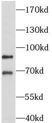 AP1G2 Antibody - BSA Free