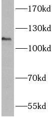 ANO3 Antibody - BSA Free