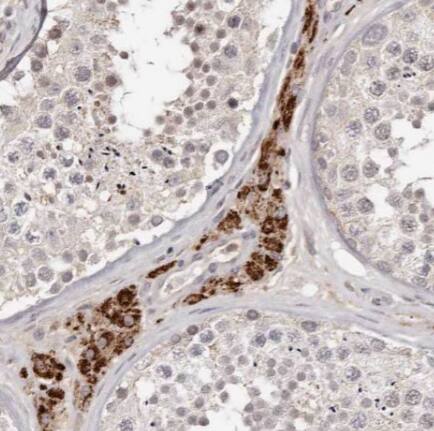 TMEM16K Antibody - BSA Free