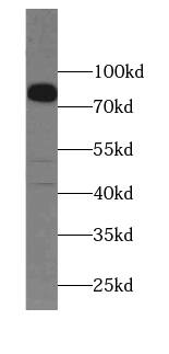 TMEM16K Antibody - BSA Free