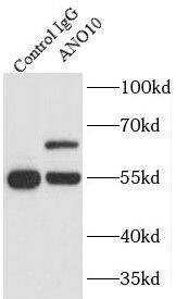 TMEM16K Antibody - BSA Free