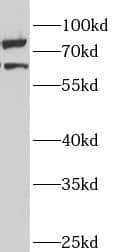ANKS3 Antibody - BSA Free