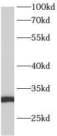 ANKRD7 Antibody - BSA Free