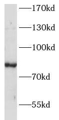 ANKRD6 Antibody - BSA Free