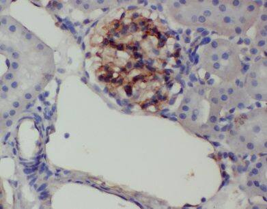 ANKRD6 Antibody - BSA Free