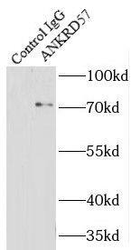 ANKRD57 Antibody - BSA Free