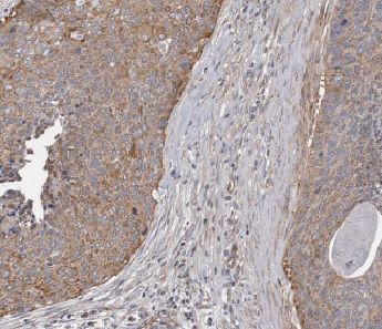 ANKRD55 Antibody - BSA Free