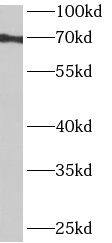 ANKRD55 Antibody - BSA Free