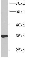ANKRD54 Antibody - BSA Free