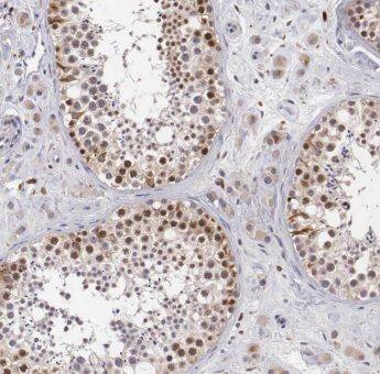 ANKRD54 Antibody - BSA Free