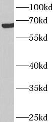 ANKRD53 Antibody - BSA Free