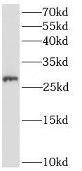 ANKRD49 Antibody - BSA Free