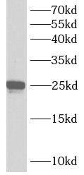 Ankyrin repeat domain 39 Antibody - BSA Free