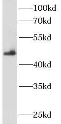 ANKRD33 Antibody - BSA Free