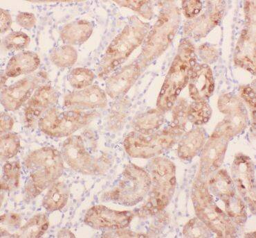 ANKRD2 Antibody - BSA Free