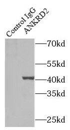 ANKRD2 Antibody - BSA Free