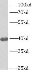 ANKRD2 Antibody - BSA Free
