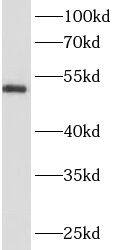ANKRD13D Antibody - BSA Free