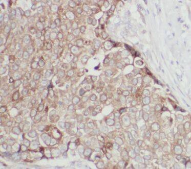 ANKRD13D Antibody - BSA Free