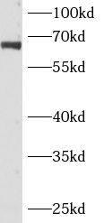 ANKRD13C Antibody - BSA Free
