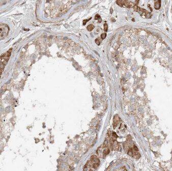 ANKRD13C Antibody - BSA Free