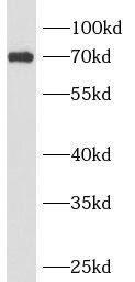 ANKRD13B Antibody - BSA Free