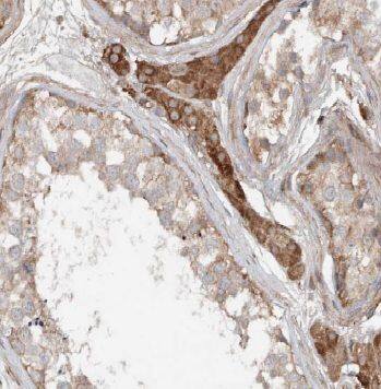 ANKRD13B Antibody - BSA Free