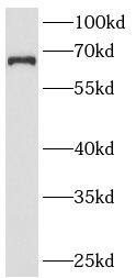 ANKRD13A Antibody - BSA Free