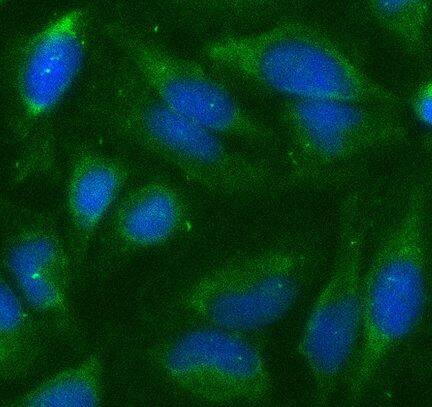 LEM3 Antibody - BSA Free